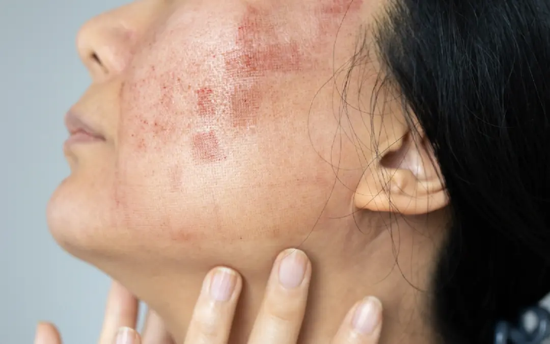 Alergista e imunologista: o que são? Há diferenças?